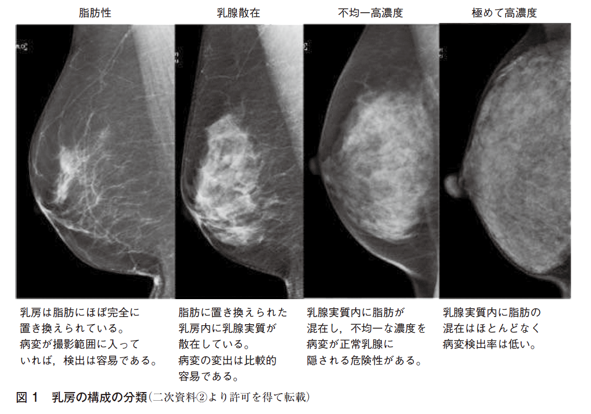 FRQ1 マンモグラフィの乳房構成の判定に自動測定ソフトを用いることは 