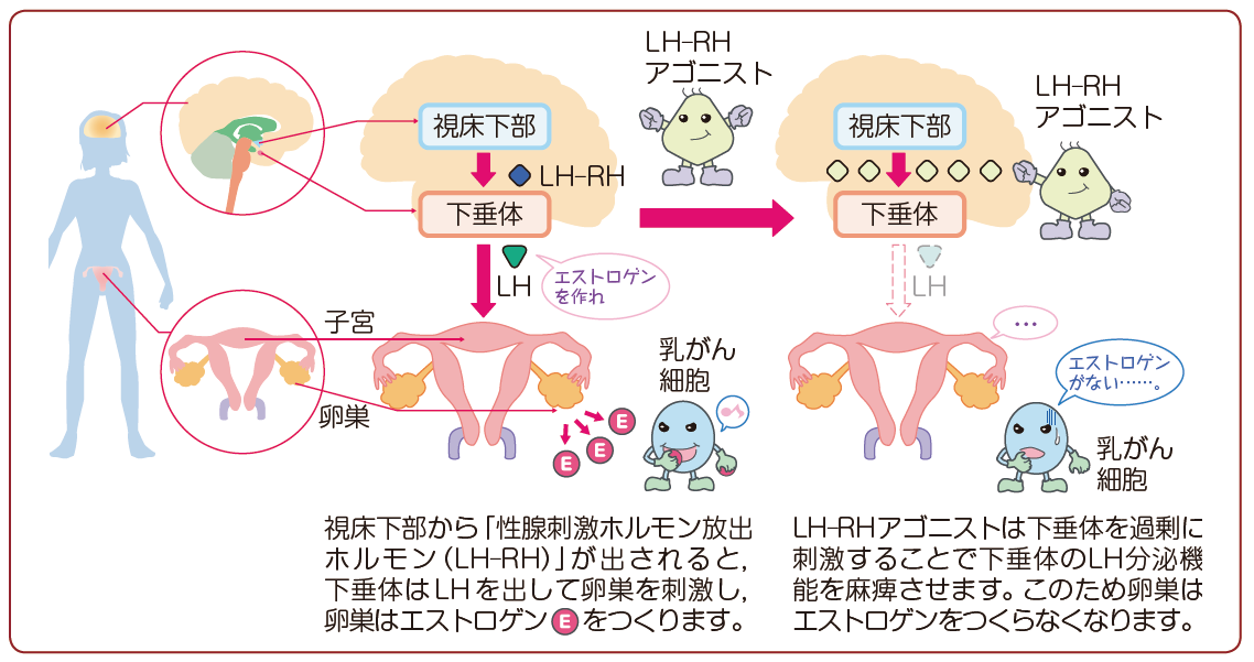 アロマターゼ阻害剤の適任者は誰ですか?