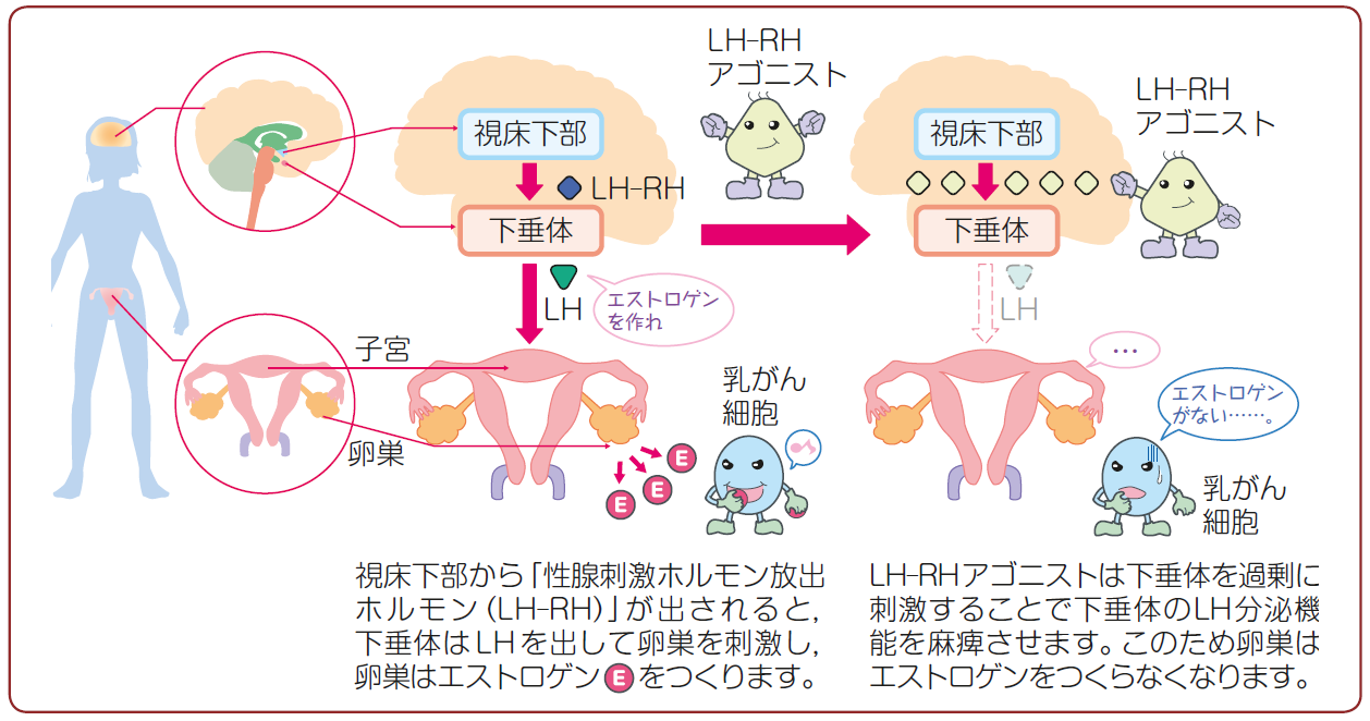 Q51 ホルモン療法薬 内分泌療法薬 はどのような効果があるのでしょうか ガイドライン 患者さんのための乳癌診療ガイドライン19年版